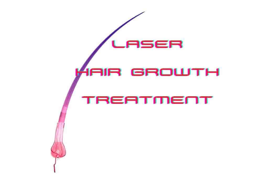 laser hair growth treatment