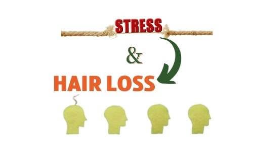 Stress and hair loss